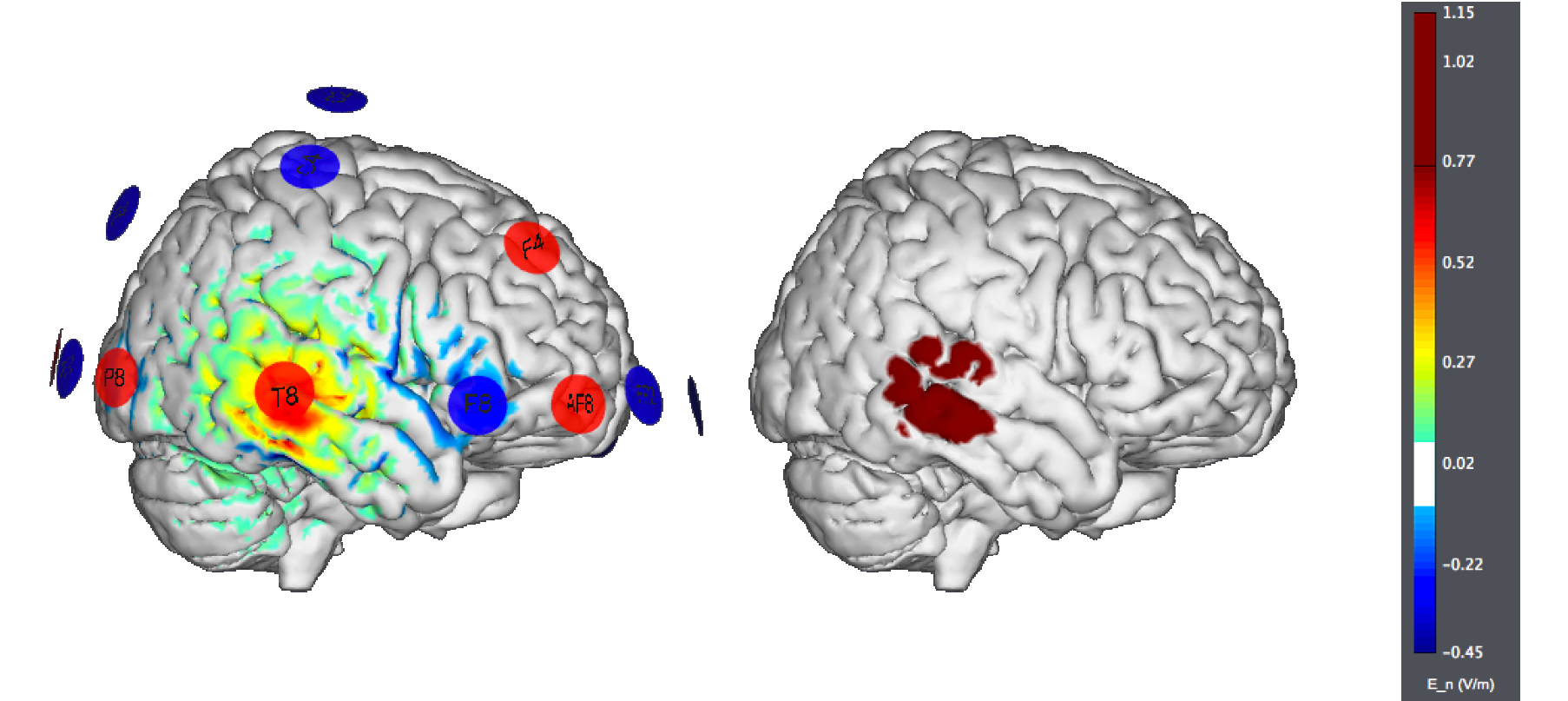 Epilepsy27Ch v2.png