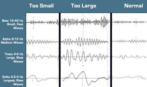 Orignially neurofeedback.JPG